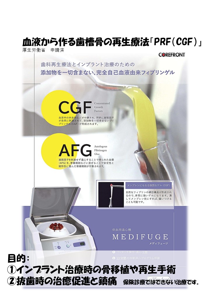 血液から作る歯槽骨の再生療法「PRF（CGF）」 - 新潟市中央区